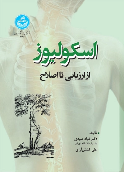 اسکولیوز
