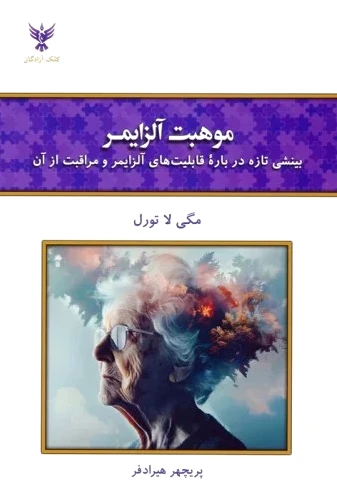 موهبت آلزایمر