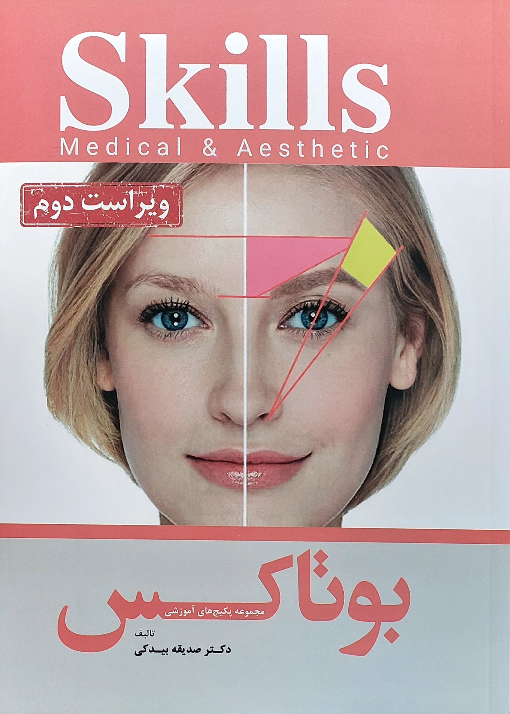 بوتاکس