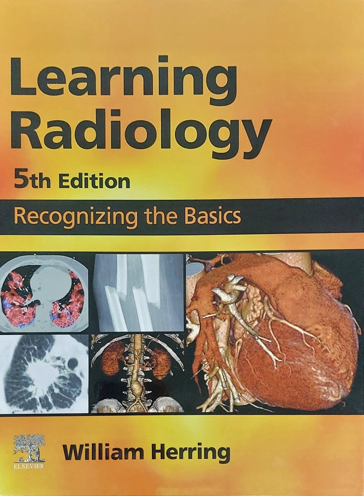 Learning Radiology: Recognizing the Basics
