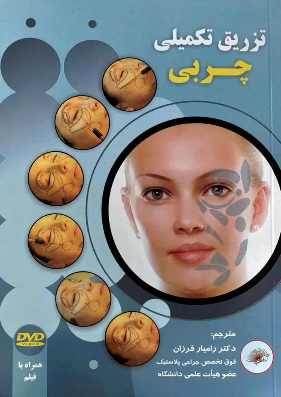 تزریق تکمیلی چربی
