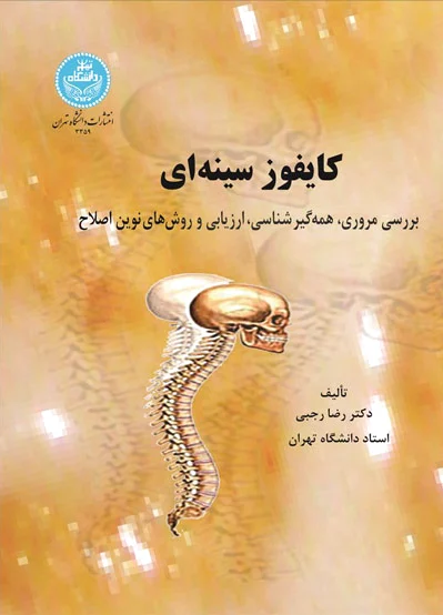 کایفوز سینه‌ ای
