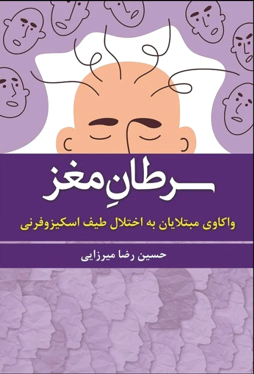 سرطان مغز